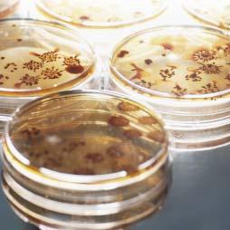 	• Cover image of Attributing U.S. Campylobacteriosis Cases to Food Sources, Season, and Temperature